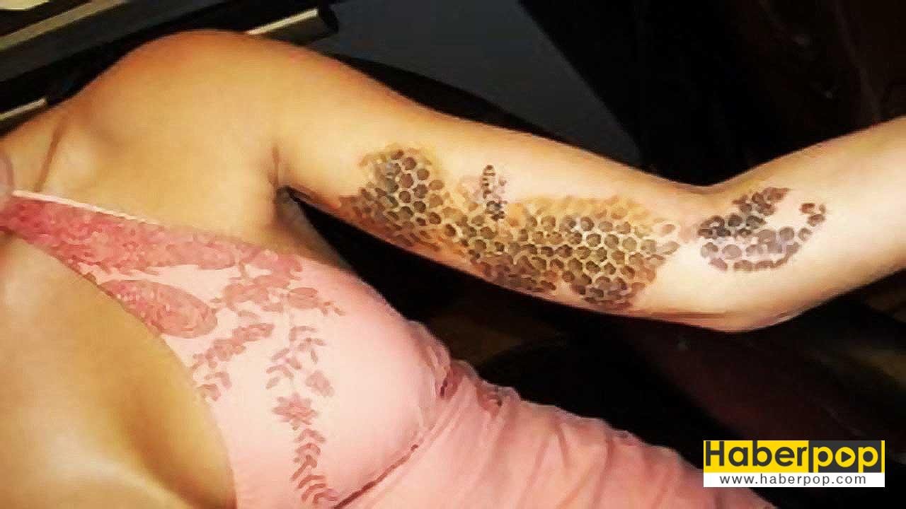 delik-fobisi_Tripofobi-nedir_Tripofobi-nedenleri_Tripofobia_Tripofobi-testi_delik-fobisi_Trypophobia