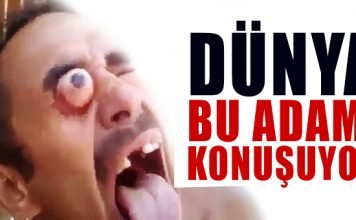 Gözleri yerinden fırlayan adam, görenleri korkuttu