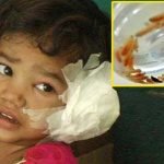 Kız çocuğun kulağından 80 kurtçuk çıktı