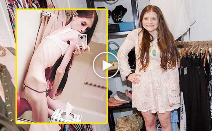 kiz-kardesiyle-inatlasti-olumden-dondu-ilginc-haber-izle-video