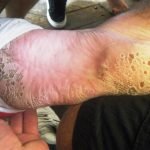 Tripofobi-36-HaberPop