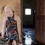 albino-siyahlar-04-haberpop