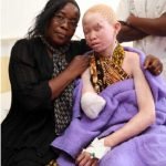 albino-siyahlar-10-haberpop