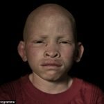 albino-siyahlar-11-haberpop