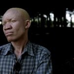 albino-siyahlar-13-haberpop