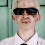 albino-siyahlar-14-haberpop