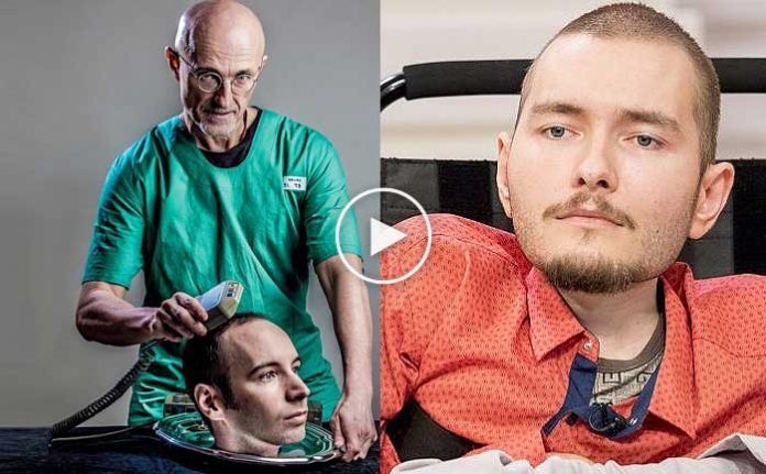 dunyanin-ilk-kafa-nakli-yapildi