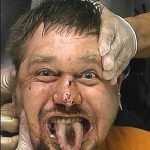 kafasini-polis-aracina-vurarak-parcalayan-kelsey-smith-karalkola-geldiginde-hala-sakinlesmemis-gibi-gmrunuyor