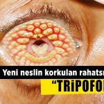 27 fotoğrafta yeni çağın korkulu rüyası delik fobisi: Tripofobi