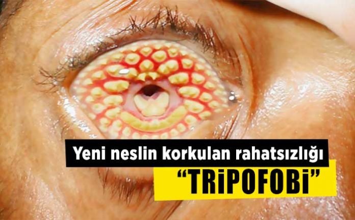 tripofobi_nedir_tedavisi