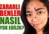 Hangi Benler Tehlikelidir? Vücuttaki ve Yüzdeki Benler Nasıl Geçer?